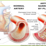 Cardiac Treatment – GIOSTAR