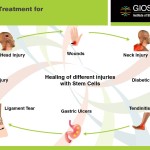 Stem Cell Treatment for Injuries