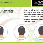 Stem Cell Treatment for Hair Loss