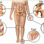 Osteoarthritis Treatment Giostar