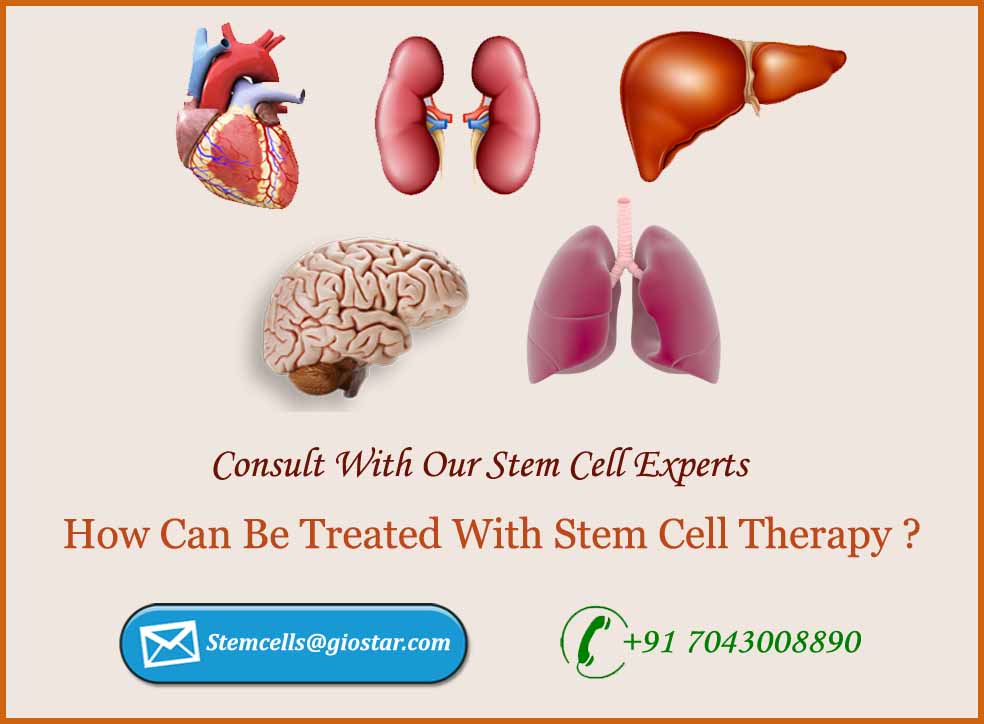 Stem Cell Therapy - GIOSTAR