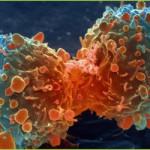 Cancer Treatment – GIOSTAR