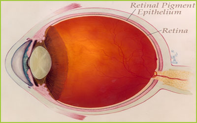 Retinal Treatment - GIOSTAR