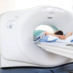 GIOSTAR Stem Cell Therapy