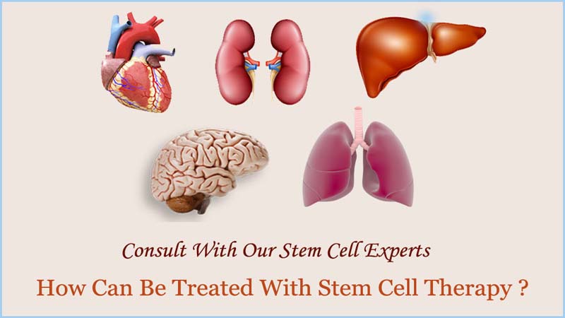 Stem Cell Treatment in India